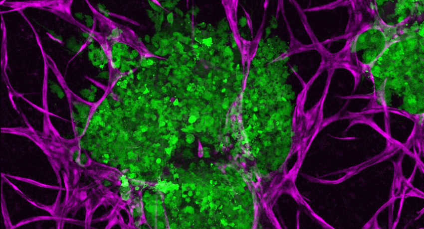 micro-environment of breast cancer