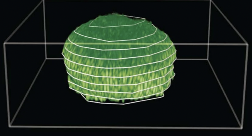 3D image of biofilm reconstruction