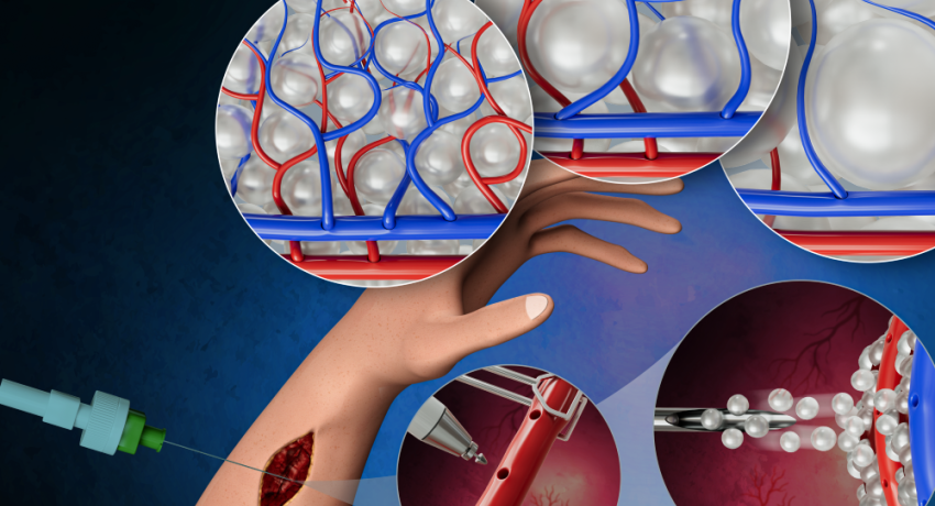 Illustration of biomaterial and microsurgery