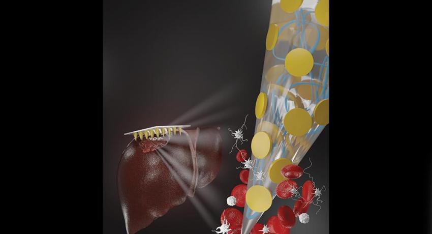 Stylized graphic of a needle bandage stopping bleeding at a microscopic level