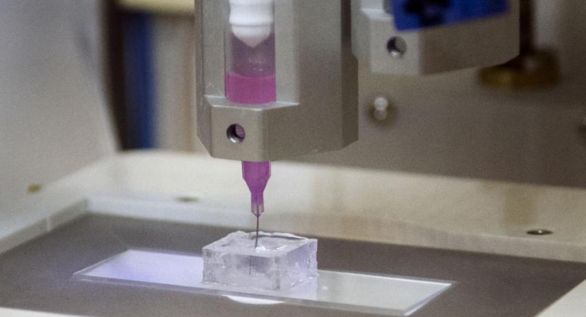 Bioprinting Breast Cancer Tumor